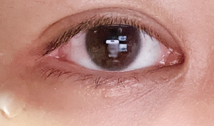before_image