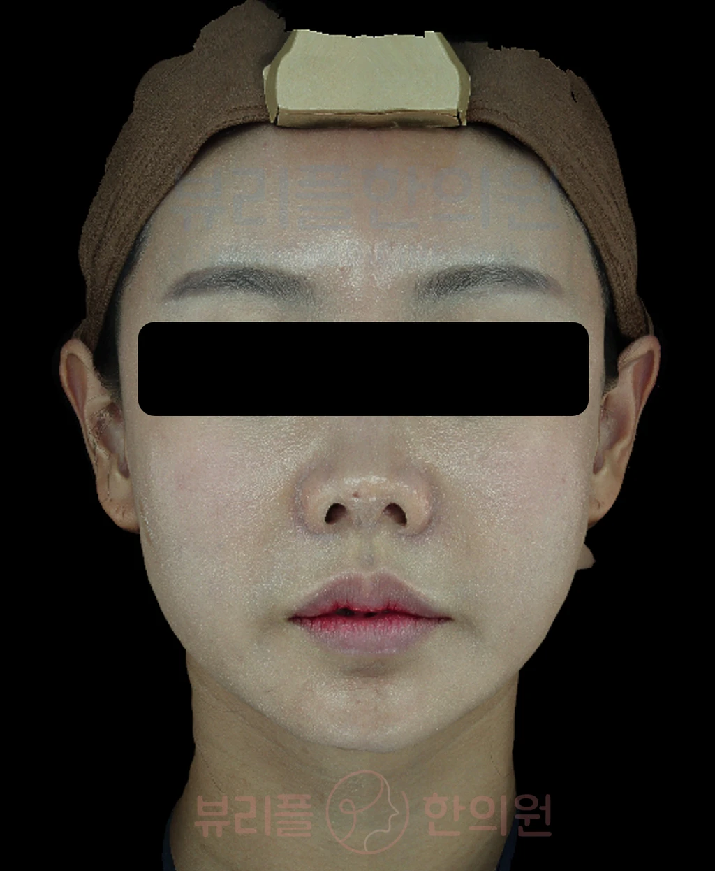 before_image