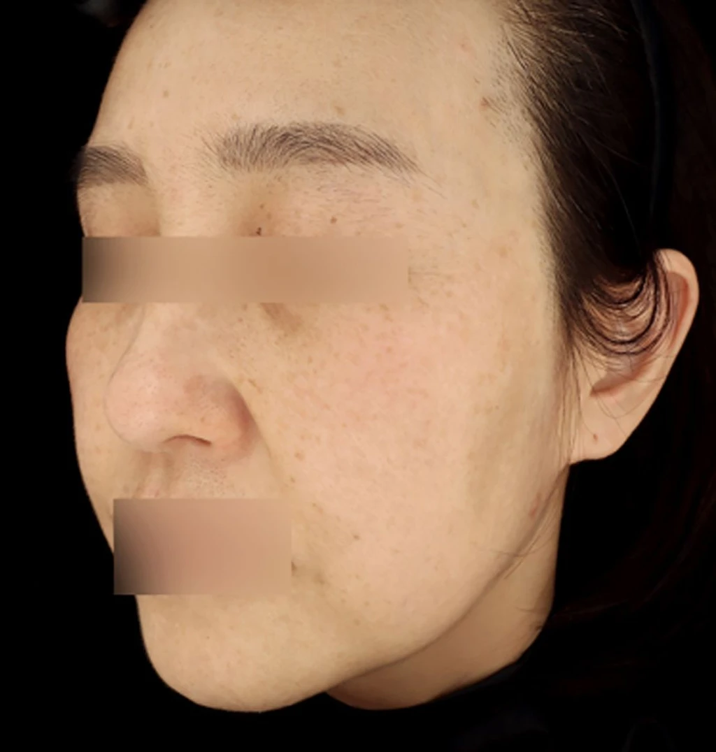 before_image