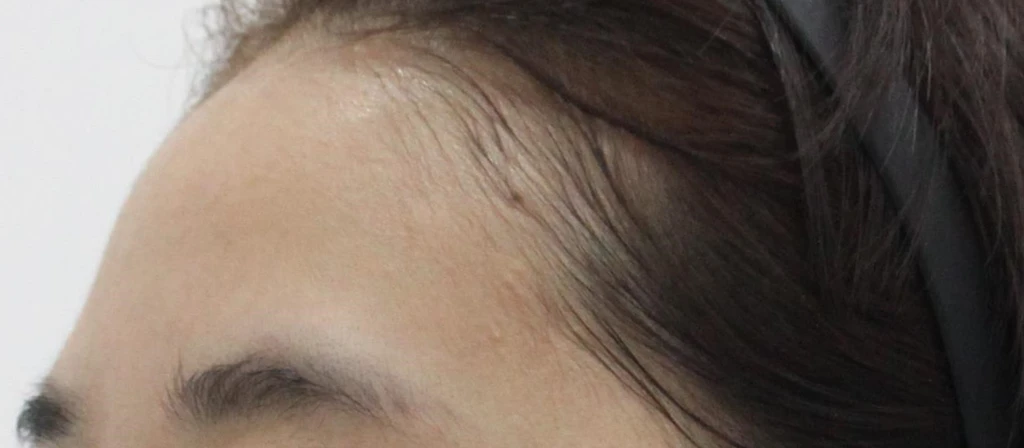 before_image