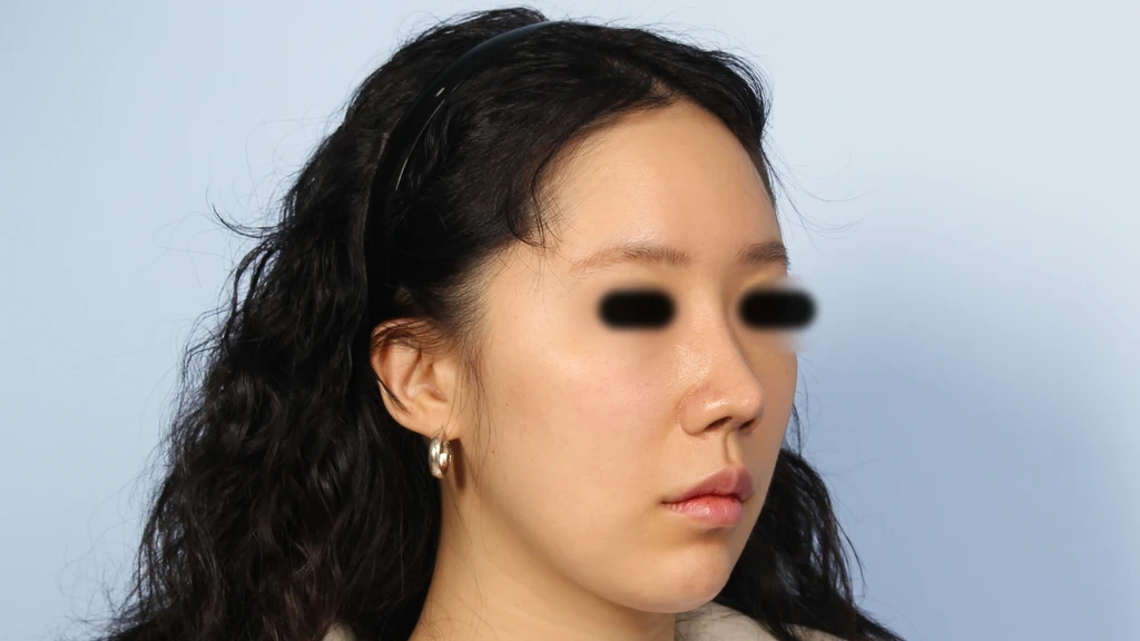 before_image