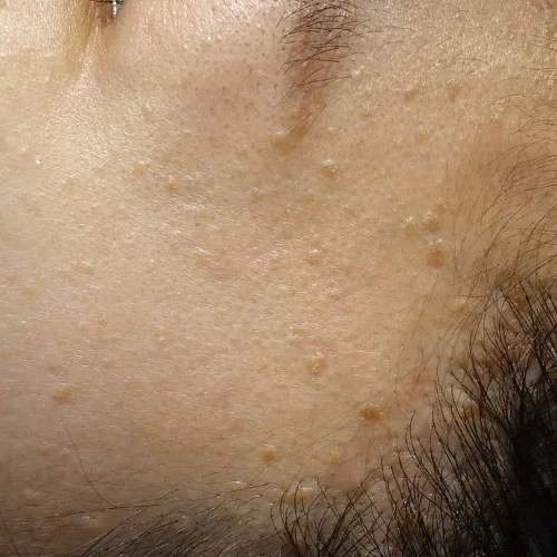 before_image