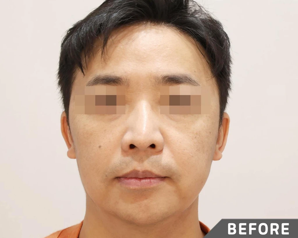 before_image