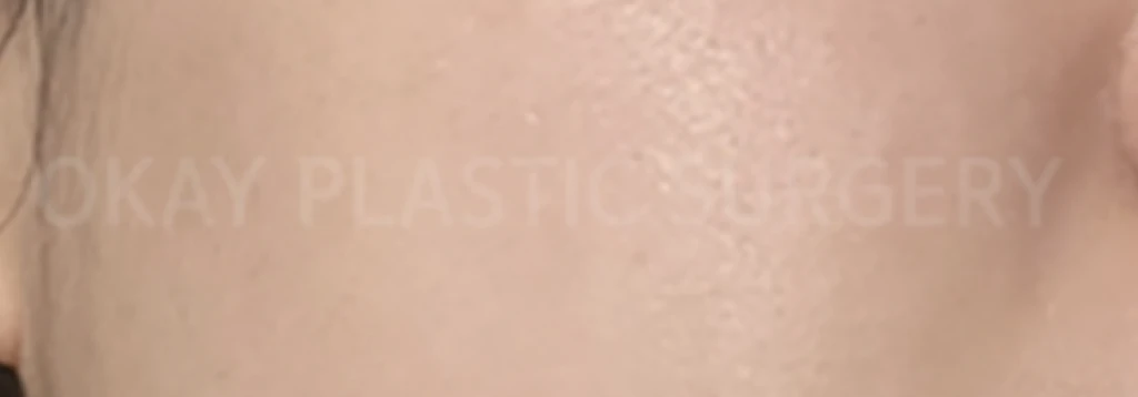 before_image