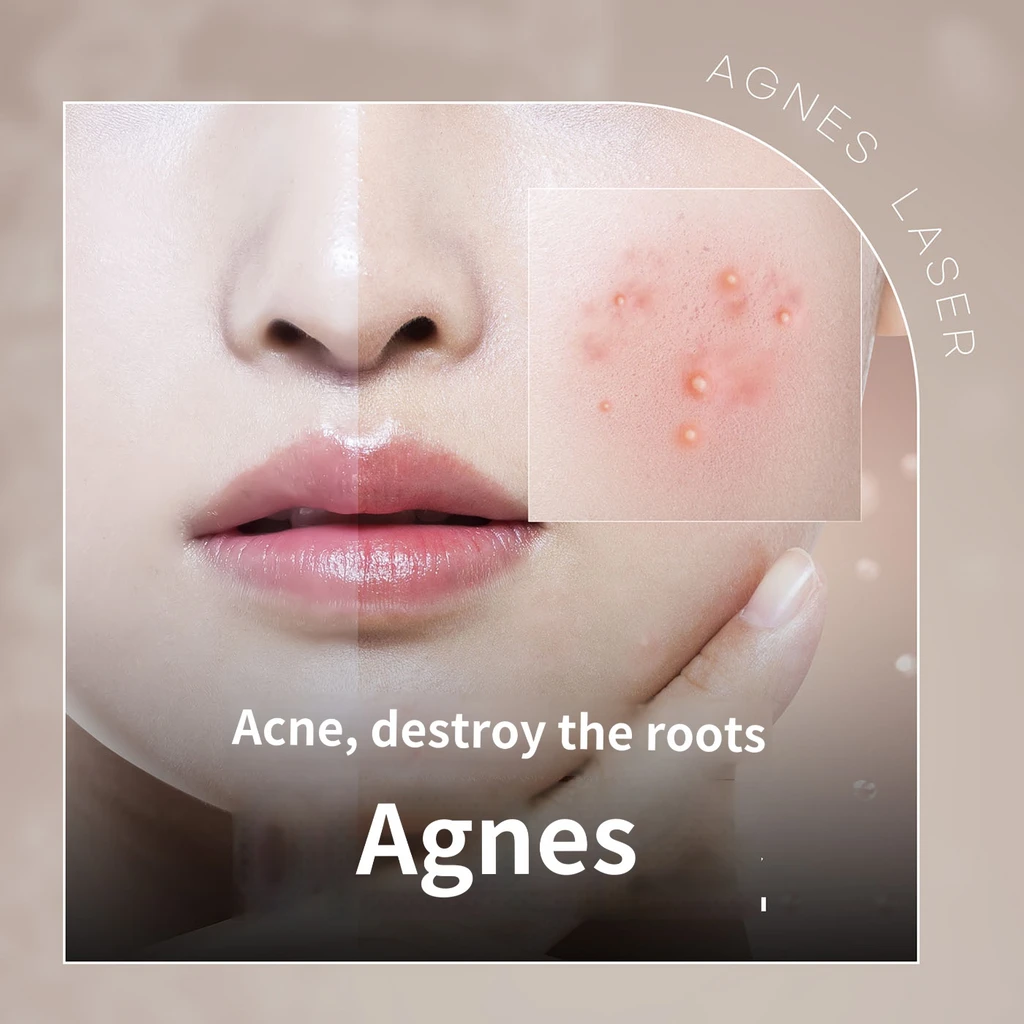 event thumbnail image