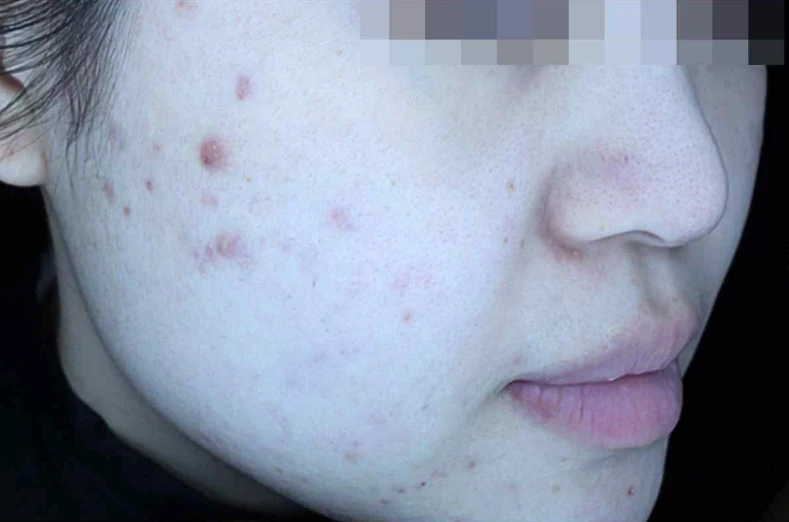 before_image