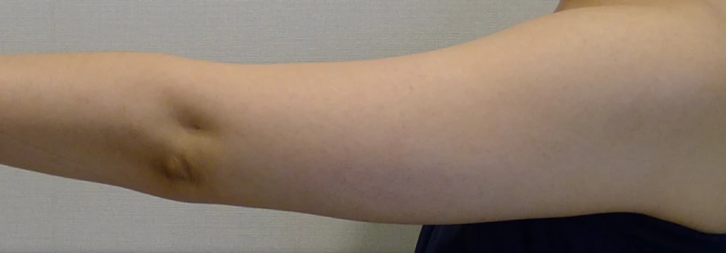 before_image