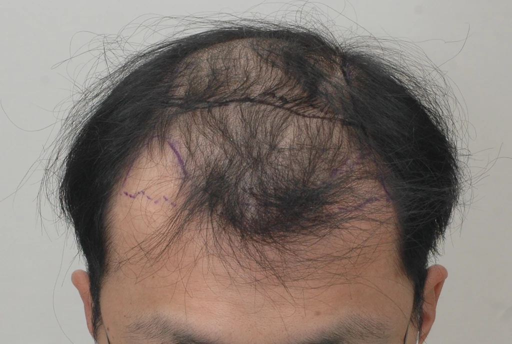 before_image