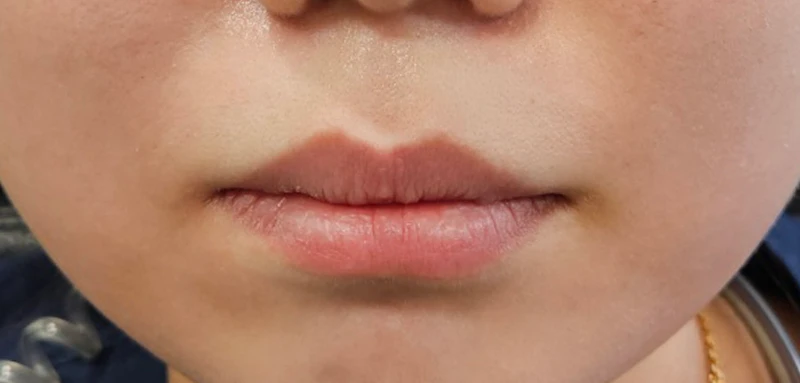 before_image