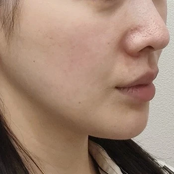 before_image