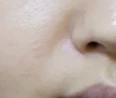 before_image