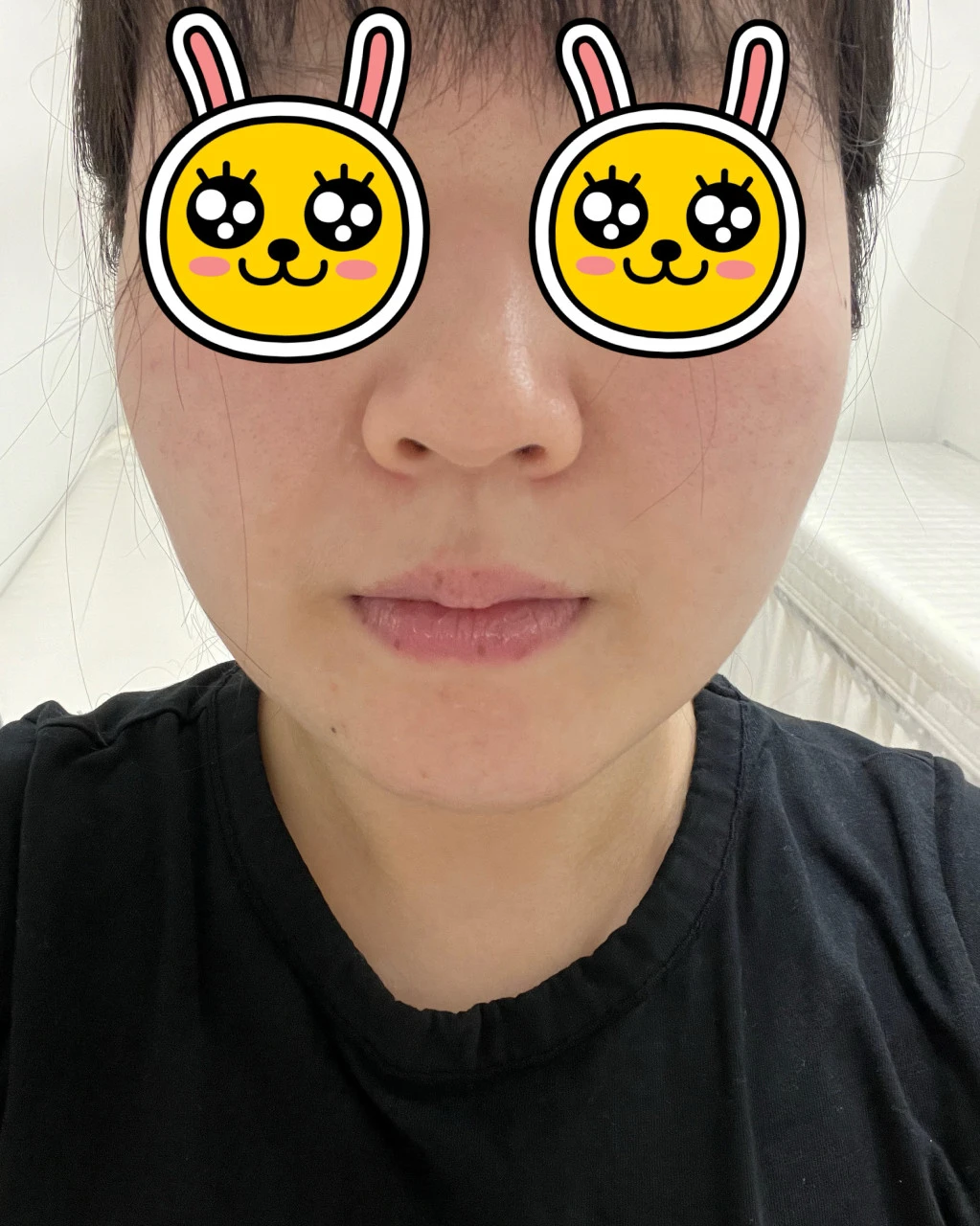 before_image