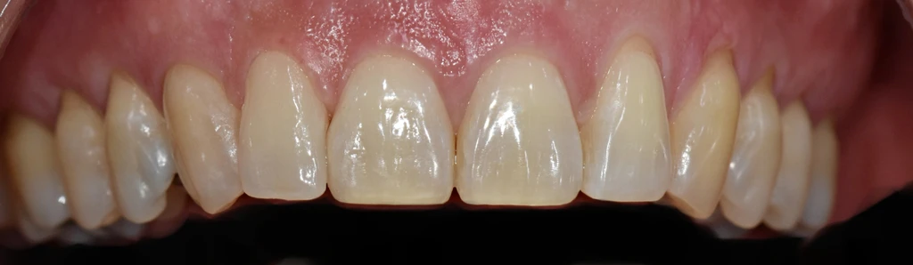 before_image