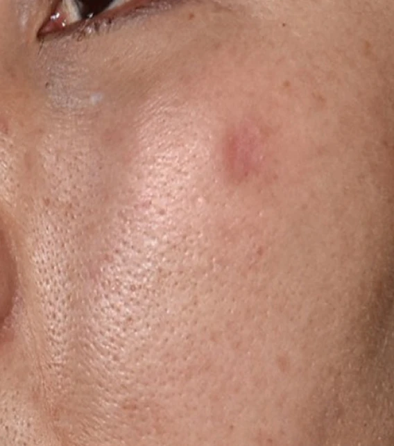 before_image