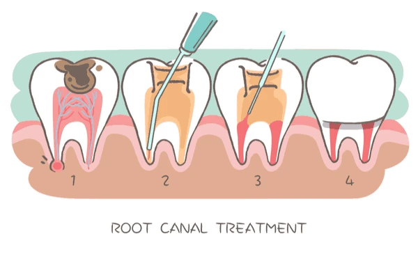 treatmentIntroduction
