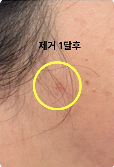 before_image