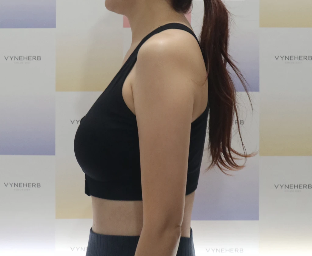 before_image