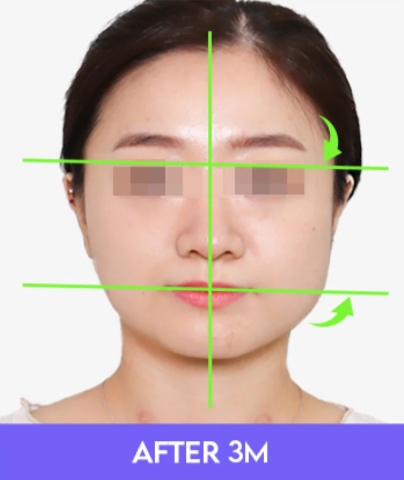 before_image