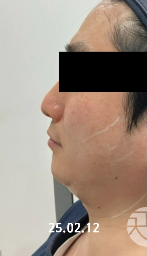 before_image