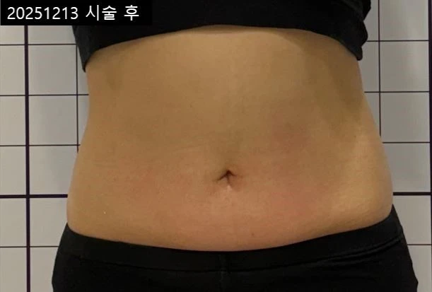 before_image
