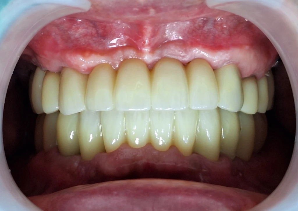 before_image