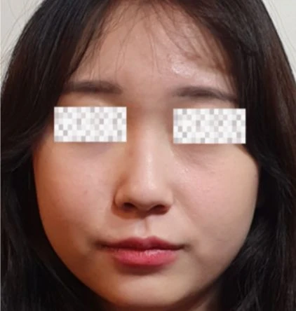 before_image