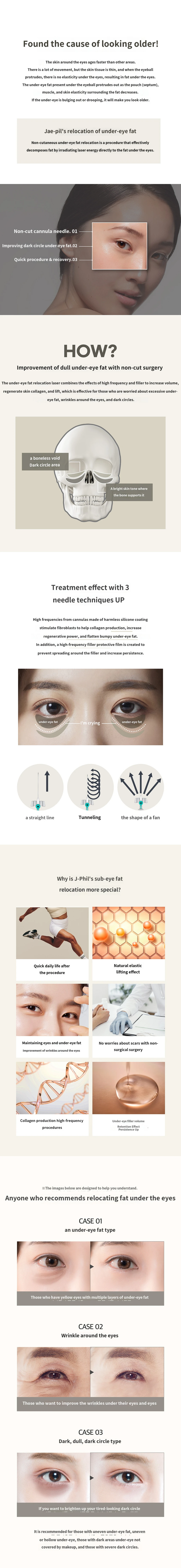 treatmentIntroduction