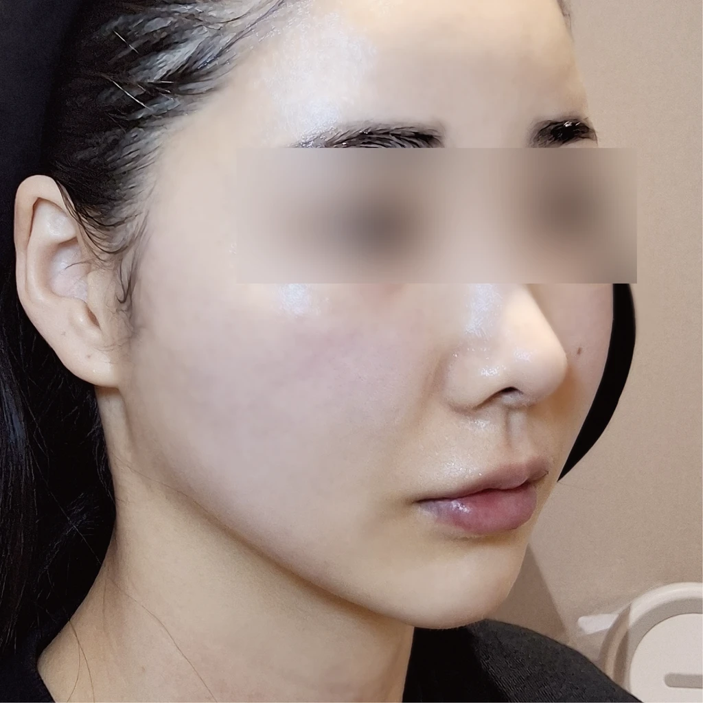 before_image