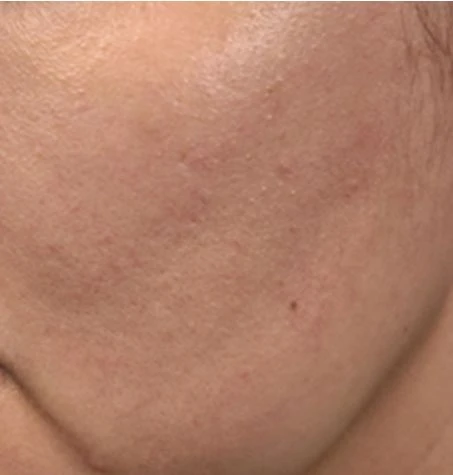 before_image