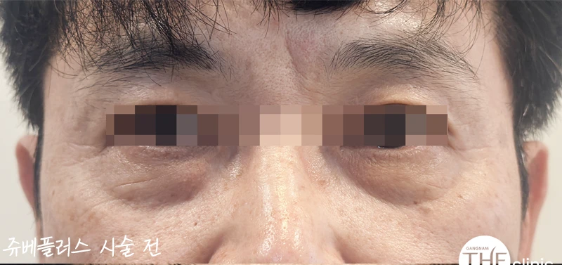 before_image