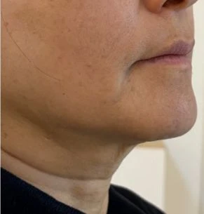 before_image