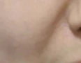 before_image