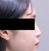 before_image