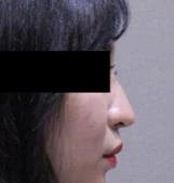 before_image