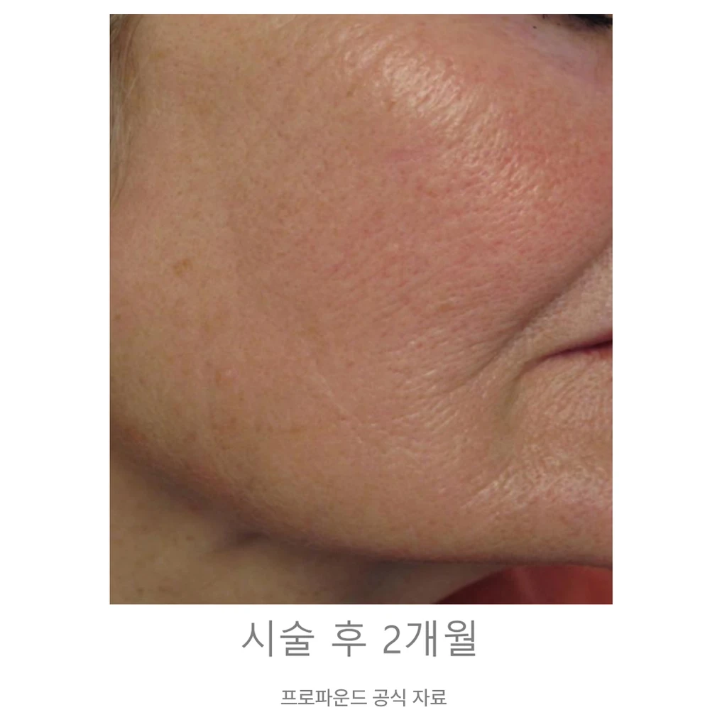 before_image