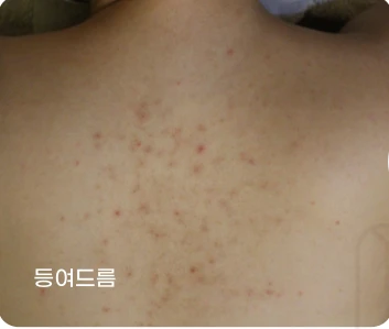 before_image