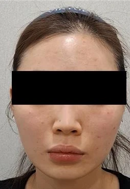 before_image