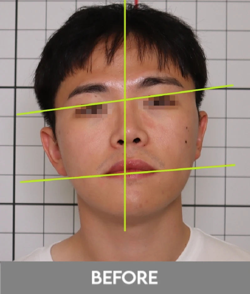before_image