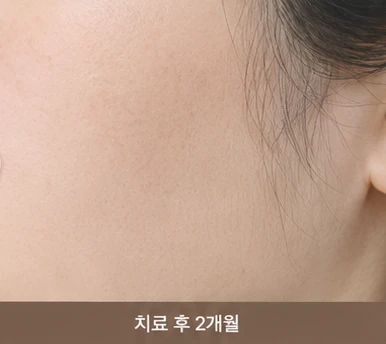 before_image