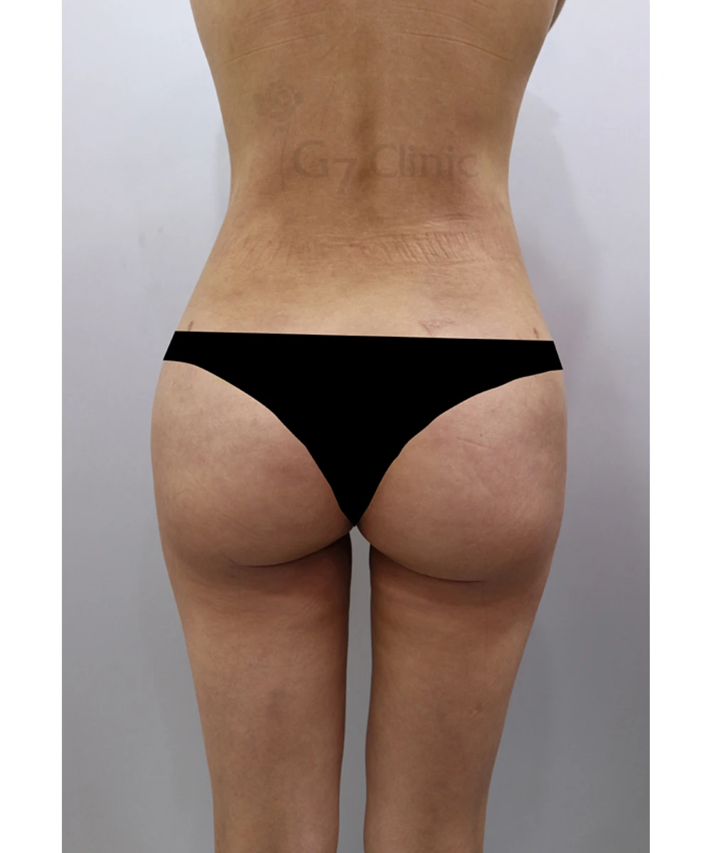 before_image
