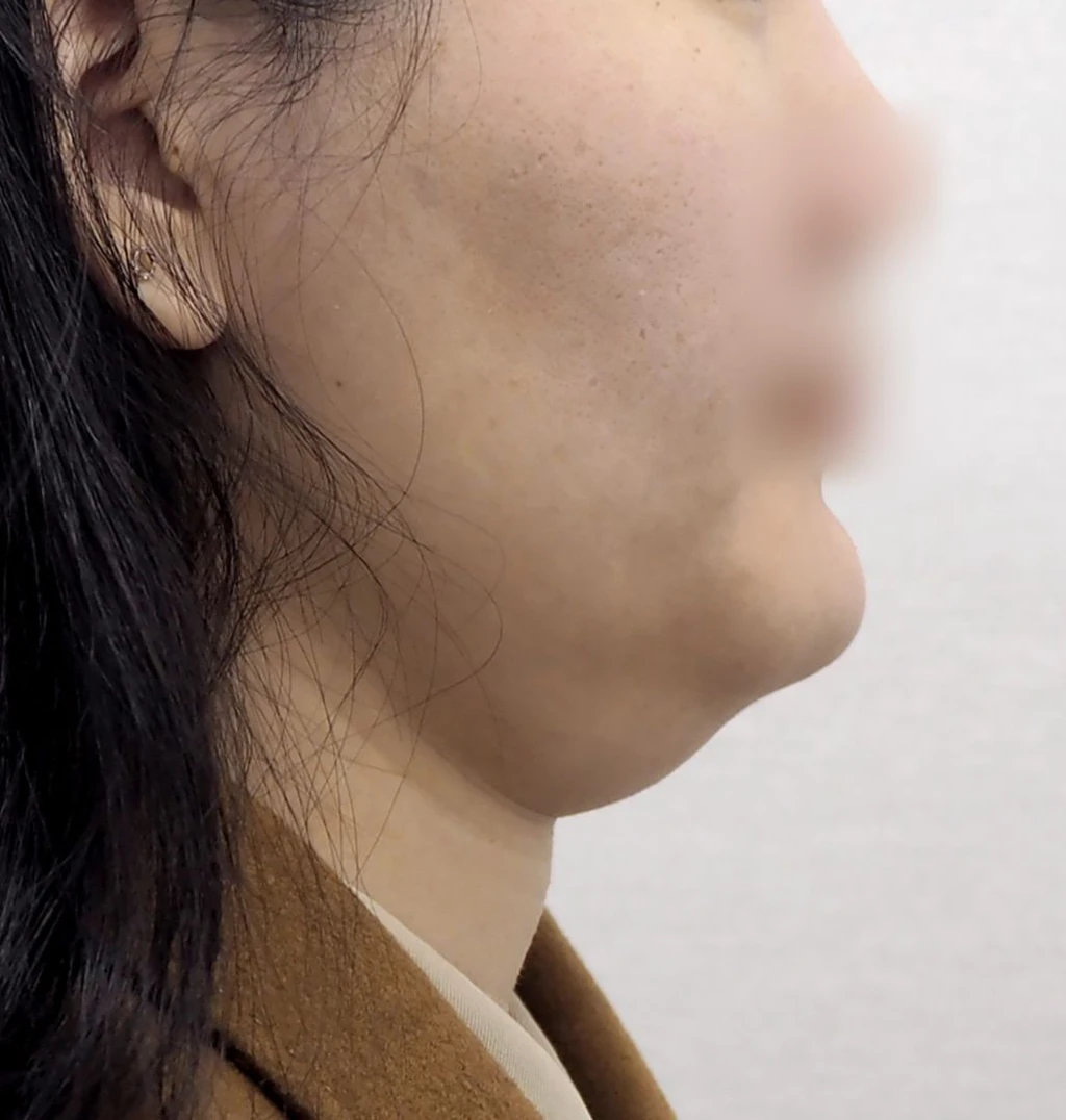 before_image