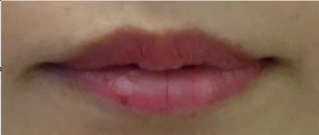 before_image