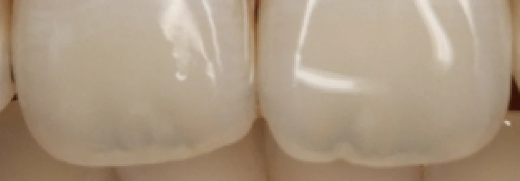 before_image