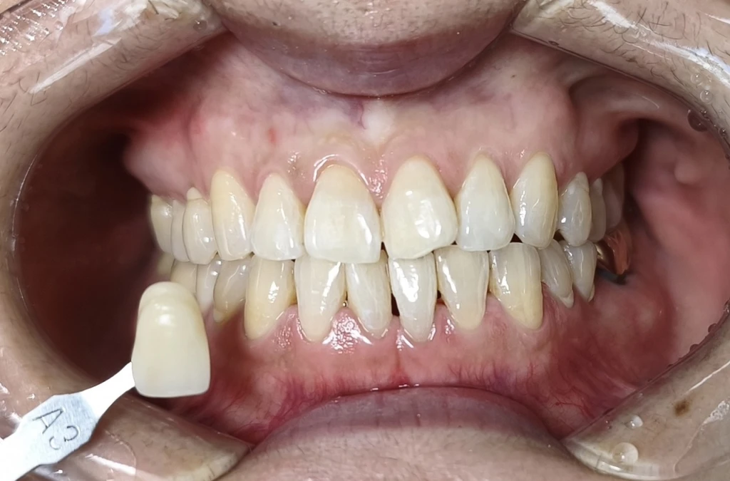 before_image