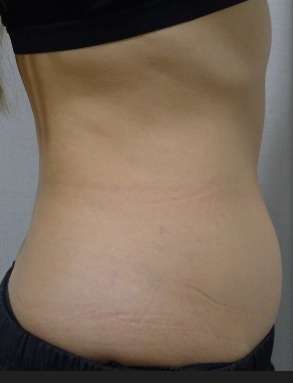 before_image