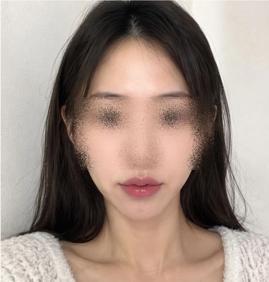 before_image
