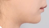 before_image