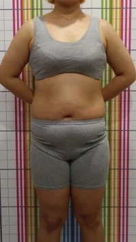 before_image