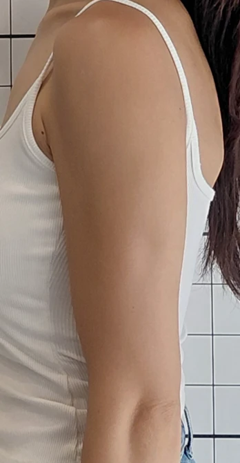 before_image