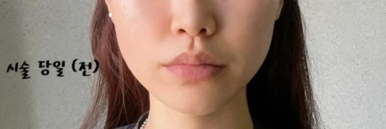 before_image